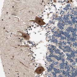 Invitrogen NGEF Polyclonal Antibody 100 &mu;L; Unconjugated:Antibodies,