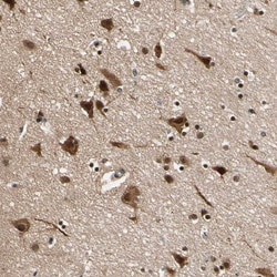 Invitrogen NGEF Polyclonal Antibody 100 &mu;L; Unconjugated:Antibodies,