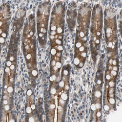 Invitrogen NGEF Polyclonal Antibody 100 &mu;L; Unconjugated:Antibodies,