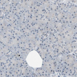 Invitrogen NGEF Polyclonal Antibody 100 &mu;L; Unconjugated:Antibodies,