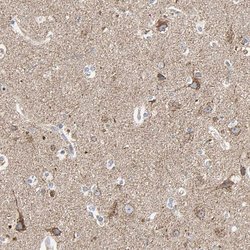 Invitrogen TSKU Polyclonal Antibody 100 &mu;L; Unconjugated:Antibodies,
