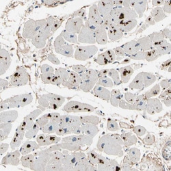 Invitrogen CRTAC1 Polyclonal Antibody 100 &mu;L; Unconjugated:Antibodies,