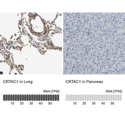 Invitrogen CRTAC1 Polyclonal Antibody 100 &mu;L; Unconjugated:Antibodies,