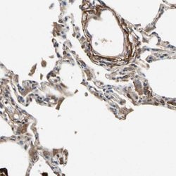 Invitrogen CRTAC1 Polyclonal Antibody 100 &mu;L; Unconjugated:Antibodies,