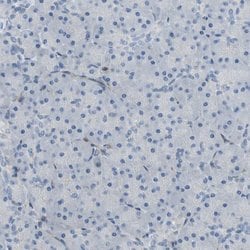 Invitrogen CRTAC1 Polyclonal Antibody 100 &mu;L; Unconjugated:Antibodies,