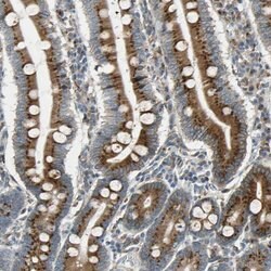 Invitrogen Nucleobindin 1 Polyclonal Antibody 100 &mu;L | Buy Online | Invitrogen&trade; | Fisher Scientific