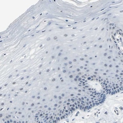 Invitrogen PSMA2 Polyclonal Antibody 100 &mu;L | Buy Online | Invitrogen&trade; | Fisher Scientific