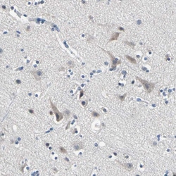 Invitrogen SELK Polyclonal Antibody 100 &mu;L; Unconjugated:Antibodies,