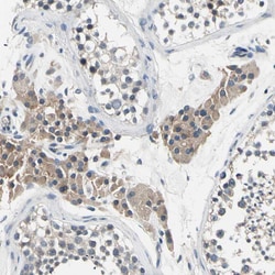 Invitrogen SELK Polyclonal Antibody 100 &mu;L; Unconjugated:Antibodies,
