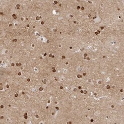 Invitrogen OMG Polyclonal Antibody 100 &mu;L; Unconjugated:Antibodies,