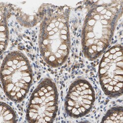 Invitrogen PLGRKT Polyclonal Antibody 100 &mu;L; Unconjugated:Antibodies,