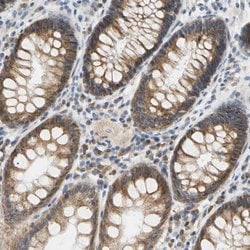 Invitrogen PLGRKT Polyclonal Antibody 100 &mu;L; Unconjugated:Antibodies,