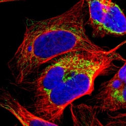 ME2 Polyclonal Antibody:Antibodies, Polyclonal