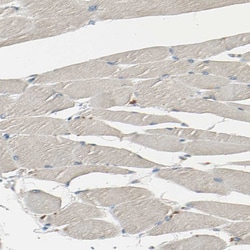 Invitrogen Ribophorin II Polyclonal Antibody 100 &mu;L; Unconjugated:Antibodies,