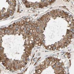 Invitrogen Ribophorin II Polyclonal Antibody 100 &mu;L; Unconjugated:Antibodies,