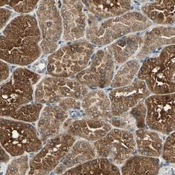 LPGAT1 Polyclonal Antibody:Antibodies, Polyclonal