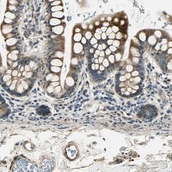 LPGAT1 Polyclonal Antibody:Antibodies, Polyclonal