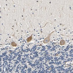 LPGAT1 Polyclonal Antibody:Antibodies, Polyclonal