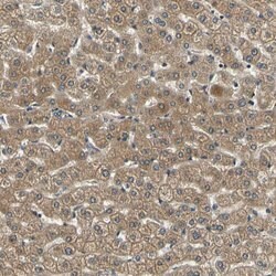 LPGAT1 Polyclonal Antibody:Antibodies, Polyclonal