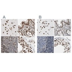 Invitrogen FAM98B Polyclonal Antibody 100 &mu;L; Unconjugated:Antibodies,