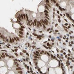 Invitrogen FAM98B Polyclonal Antibody 100 &mu;L; Unconjugated:Antibodies,