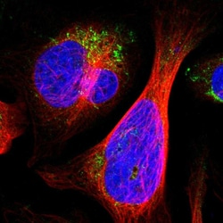 ALDH18A1 Polyclonal Antibody:Antibodies, Polyclonal