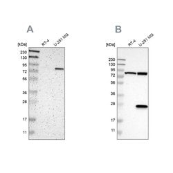 ALDH18A1 Polyclonal Antibody:Antibodies, Polyclonal