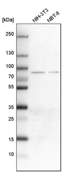 ALDH18A1 Polyclonal Antibody:Antibodies, Polyclonal