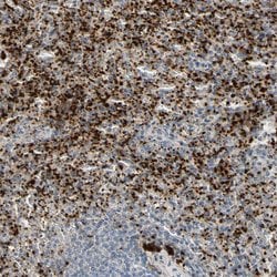 Invitrogen PPBP Polyclonal Antibody 100 &mu;L; Unconjugated:Antibodies,