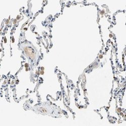 Invitrogen PPBP Polyclonal Antibody 100 &mu;L; Unconjugated:Antibodies,
