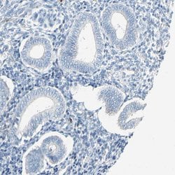 Invitrogen PPBP Polyclonal Antibody 100 &mu;L; Unconjugated:Antibodies,