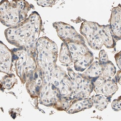 Invitrogen GPSM2 Polyclonal Antibody 100 &mu;L | Buy Online | Invitrogen&trade; | Fisher Scientific