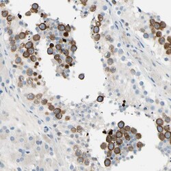 Invitrogen CKAP2 Polyclonal Antibody 100 &mu;L; Unconjugated:Antibodies,