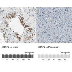 Invitrogen CKAP2 Polyclonal Antibody 100 &mu;L; Unconjugated:Antibodies,