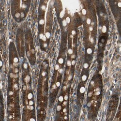 Invitrogen TCP-1 eta Polyclonal Antibody 100 &mu;L; Unconjugated:Antibodies,