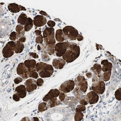 Invitrogen CCM2L Polyclonal Antibody 100 &mu;L; Unconjugated:Antibodies,