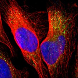 Invitrogen PANK2 Polyclonal Antibody 100 &mu;L; Unconjugated:Antibodies,