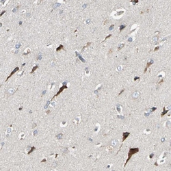 Invitrogen PANK2 Polyclonal Antibody 100 &mu;L; Unconjugated:Antibodies,