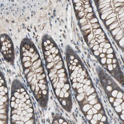 Invitrogen PANK2 Polyclonal Antibody 100 &mu;L; Unconjugated:Antibodies,