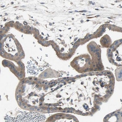 Invitrogen PANK2 Polyclonal Antibody 100 &mu;L; Unconjugated:Antibodies,