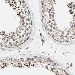 Invitrogen PANK2 Polyclonal Antibody 100 &mu;L; Unconjugated:Antibodies,