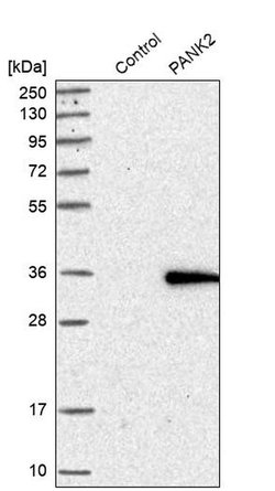 Invitrogen PANK2 Polyclonal Antibody 100 &mu;L; Unconjugated:Antibodies,