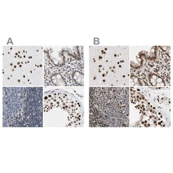 FAM98B Polyclonal Antibody:Antibodies, Polyclonal