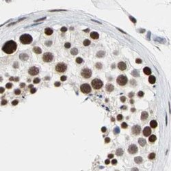 FAM98B Polyclonal Antibody:Antibodies, Polyclonal