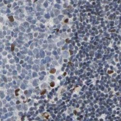 FAM98B Polyclonal Antibody:Antibodies, Polyclonal