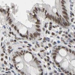 FAM98B Polyclonal Antibody:Antibodies, Polyclonal