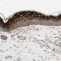 Invitrogen CCDC23 Polyclonal Antibody 100 &mu;L; Unconjugated:Antibodies,