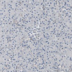 Invitrogen CCDC23 Polyclonal Antibody 100 &mu;L; Unconjugated:Antibodies,