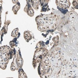 Invitrogen CCDC23 Polyclonal Antibody 100 &mu;L; Unconjugated:Antibodies,