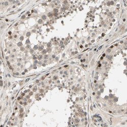 Invitrogen CCDC23 Polyclonal Antibody 100 &mu;L; Unconjugated:Antibodies,